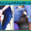 آرتروز زانو