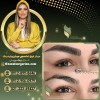 بهترین مرکز فیبروز ابرو در تهران و سراسر ایران