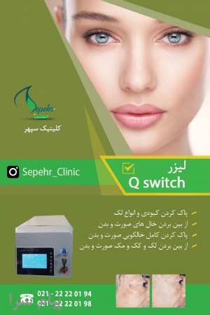 کیوسوئیچ Qswitch