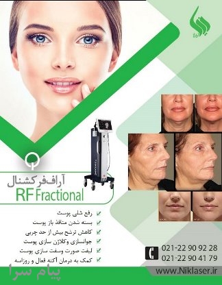 اجاره آراف فرکشنال برای درمان استریا