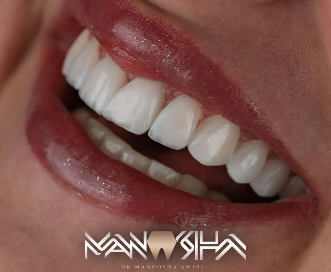 دکتر مانوشا امیری | بهترین دندانپزشکی در رشت