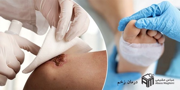 روشی نوین برای درمان زخم و سوختگی