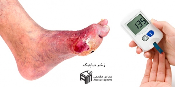 درمان زخم دیابتی | کلینیک بهبودان