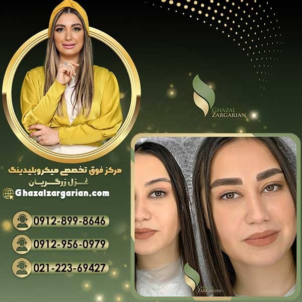 میکرو ابرو با کیفیت بالا در غرب تهران