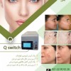اجاره دستگاه Qswitch  